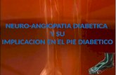 Neuroangiopatia y Su Implicacion en El Pie Diabetico
