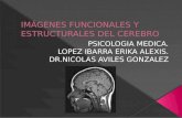 13. Imagenes Estructurales y Funcionales del Cerebro (30-Oct-2013)