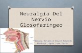 Neuralgia del nervio glosofaríngeo (1)