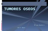 16.- TUMORES OSEOS