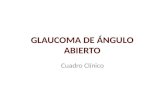 Glaucoma aa