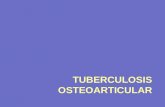 29577068 Tuberculosis Osea