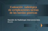 Evaluación radiológica de complicaciones tardías de las bandas gástricas Sección de Radiología Intervencionista H.U.C.