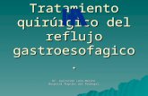 Tratamiento quirúrgico del reflujo gastroesofagico. Dr. Guillermo León Merino. Hospital Ángeles del Pedregal.
