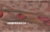 HEMORRAGIA C.D. EDUARDO CÁCERES CHOQUECUNSA. HEMORRAGIA Es una situación que provoca una pérdida de sangre, la cual puede ser interna (cuando la sangre.