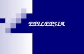 EPILEPSIA. Definición Etiología. Fisiopatología Clasificación Diagnóstico Diagnóstico diferencial Tratamiento.
