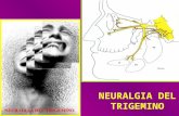 NEURALGIA DEL TRIGEMINO. Contienen fibras sensitivas o motoras, o una combinación de éstas. Son haces de prolongaciones neuronales que inervan los músculos.