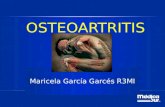OSTEOARTRITIS Maricela García Garcés R3MI. PUNTOS A TRATAR Definición Epidemiología Factores de riesgo Fisiopatología Etiología Cuadro clínico Diagnóstico.
