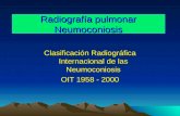 Radiografía pulmonar Neumoconiosis Clasificación Radiográfica Internacional de las Neumoconiosis OIT 1958 - 2000.