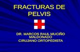 FRACTURAS DE PELVIS DR. MARCOS RAUL MUCIÑO MALDONADO CIRUJANO ORTOPEDISTA.