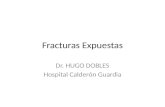 Fracturas Expuestas Dr. HUGO DOBLES Hospital Calderón Guardia.