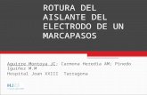 Aguirre Montoya JC; Carmona Heredia AM; Pinedo Iguíñez M.M Hospital Joan XXIII Tarragona ROTURA DEL AISLANTE DEL ELECTRODO DE UN MARCAPASOS.