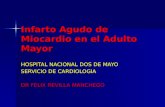 Infarto Agudo de Miocardio en el Adulto Mayor HOSPITAL NACIONAL DOS DE MAYO SERVICIO DE CARDIOLOGIA DR FELIX REVILLA MANCHEGO.