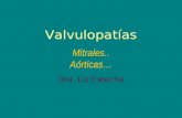 Valvulopatías Mitrales.. Aórticas… Dra. Liz Fatecha.
