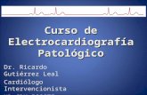 Curso de Electrocardiografía Patológico Dr. Ricardo Gutiérrez Leal Cardiólogo Intervencionista HR CRM ISSSTE.