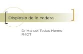 Displasia de la cadera Dr Manuel Testas Hermo R4OT.