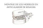Montaje de Los Modelos en Articulador de Bisagra