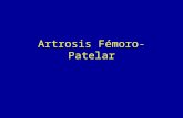 Artrosis Fémoro-Patelar. Tróclea Femoral Plica infra-patelar Ligamento adiposo Rótula.