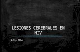 LESIONES CEREBRALES EN HIV Julio 2014. SNC ▪ 35 % HIV sufren o sufrirán síntomas neurológicos en el curso de su enfermedad. ▪ 75 % de los estudios autópsicos.