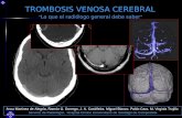 TROMBOSIS VENOSA CEREBRAL “ Lo que el radiólogo general debe saber ” Anxo Martinez de Alegría, Ramón G. Dorrego, J. A. Castiñeira, Miguel Blanco, Pablo.