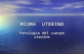 MIOMA UTERINO Patologia del cuerpo uterino. MIOMA Definición Definición Prevalencia – Incidencia Prevalencia – Incidencia Factores de Riesgo Factores.