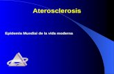 Epidemia Mundial de la vida moderna Aterosclerosis.