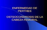 ENFERMEDAD DE PERTHES OSTEOCONDROSIS DE LA CABEZA FEMORAL.