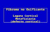 Fibroma no Osificante L aguna Cortical Metafisiaria (defecto cortical)
