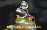 Problemas visuales (2)