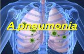A pneumonía   adrián alonso vilar - 3ºeso-b