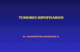 44. tumores hipofisarios