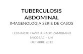 Tuberculosis abdominal