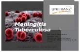 Tuberculose Meníngea - Meningites Tuberculosa