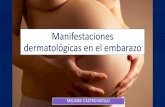 Manifestaciones dermatológicas en el embarazo