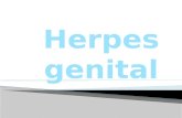 Herpes genital