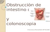 Obstrucción intestinal. Colonoscopia