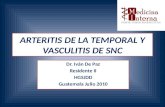 Arteritis De La Temporal Y Vasculitis De Snc