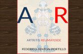 Arthritis Reumatoide