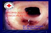 Trombolisis y angioplastia hesv