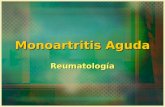 Monoartritis Aguda
