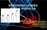 DEFORMIDADES DE RODILLA
