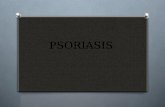 Psoriasis olgamock
