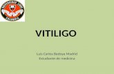 Vitiligo - dermatologia
