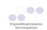 Espondiloartropatias Seronegativas CLASE ENTERA
