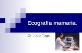 Ecosonografía Mamaria