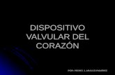 Dispositivo Valvular Del Corazon -> Futura  Médica