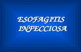 Esofagitis Infecciosa Expo