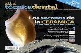 alta tecnica dental - los secretos de la ceramica