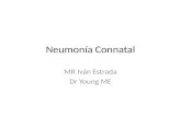 Neumonía Connatal