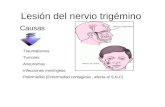 Lesión del nervio trigémino-dicertacion
